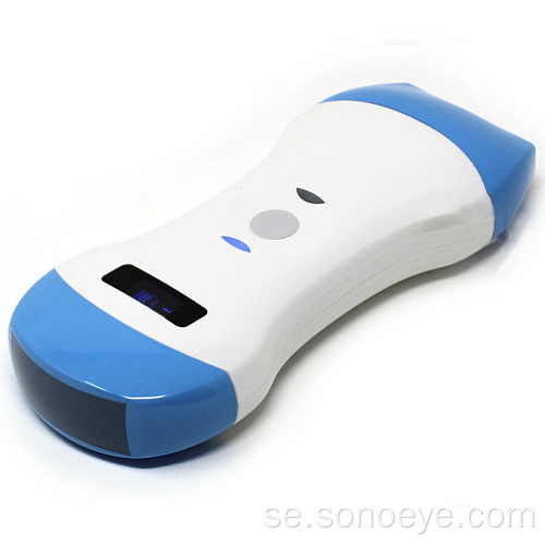 Sonostar Uprobe Wireless Probe Ultrasound